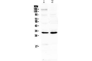 Western blot analysis of IL1 beta using anti-IL1 beta antibody . (IL-1 beta Antikörper)