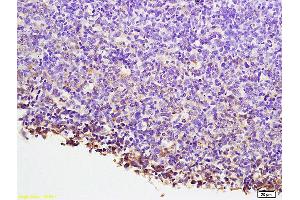 Formalin-fixed and paraffin embedded mouse lymphoma labeled with Anti-NFATC1/NFAT2 Polyclonal Antibody, Unconjugated (ABIN686257) at 1:200 followed by conjugation to the secondary antibody and DAB staining. (NFATC1 Antikörper  (AA 601-716))