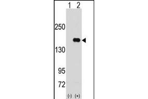 Western blot analysis of PUM2 (arrow) using rabbit polyclonal PUM2 Antibody (N-term) (ABIN391821 and ABIN2841667). (PUM2 Antikörper  (N-Term))