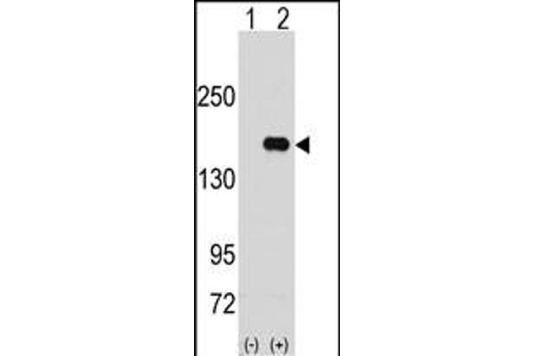 PUM2 Antikörper  (N-Term)