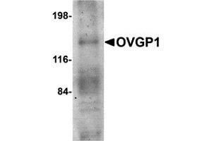 Western Blotting (WB) image for anti-Oviductal Glycoprotein 1 (OVGP1) (N-Term) antibody (ABIN1031498) (OVGP1 Antikörper  (N-Term))