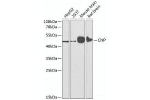 Western blot analysis of extracts of various cell lines using CNP Polyclonal Antibody at dilution of 1:1000. (Cnpase Antikörper)