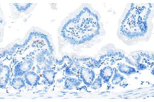 Immunohistochemistry (IHC) image for anti-CD28 (CD28) (AA 170-220) antibody (ABIN7455122) (Rekombinanter CD28 Antikörper  (AA 170-220))