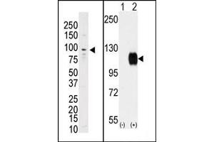 Image no. 1 for anti-TYRO3 Protein Tyrosine Kinase (TYRO3) (C-Term) antibody (ABIN359940) (TYRO3 Antikörper  (C-Term))