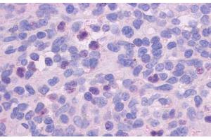 Anti-FPR1 antibody  ABIN1048601 IHC staining of human spleen. (FPR1 Antikörper  (Extracellular Domain))
