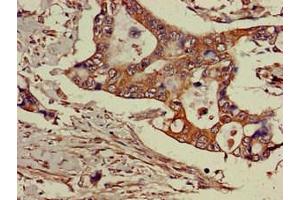 Immunohistochemistry (IHC) image for anti-Golgi-Associated, gamma Adaptin Ear Containing, ARF Binding Protein 3 (GGA3) (AA 342-503) antibody (ABIN7143469)