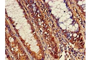 Immunohistochemistry (IHC) image for anti-ATPase, Na+/K+ Transporting, beta 3 Polypeptide (ATP1B3) (AA 57-279) antibody (ABIN7170052)