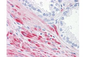Immunohistochemistry (IHC) image for anti-ADAM Metallopeptidase with thrombospondin Type 1 Motif, 17 (ADAMTS17) (AA 543-651) antibody (ABIN574473)
