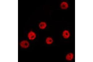 ABIN6277656 staining Hela by IF/ICC. (ZEB1 Antikörper  (Internal Region))