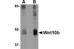 Western blot analysis of Wnt10b in human skeletal muscle tissue lysate with this product at (A) 2 and (B) 4 μg/ml. (WNT10B Antikörper  (Center))