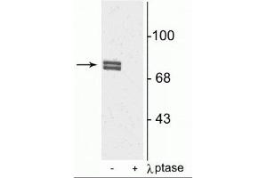 Western blot of rat cortical lysate showing specific immunolabeling of the ~80 kDa doublet of 5-LO phosphorylated at Ser523 in the first lane (-). (ALOX5 Antikörper  (pSer523))