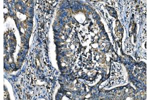IHC analysis of CX3CR1 using anti-CX3CR1 antibody (ABIN7599293). (CX3CR1 Antikörper  (AA 1-345))