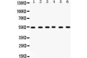 Western Blotting (WB) image for anti-Dihydrolipoamide Dehydrogenase (DLD) (AA 300-509) antibody (ABIN3043561) (DLD Antikörper  (AA 300-509))