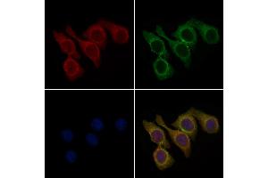 ABIN7094784 and ABIN7098835 staining Hela cells by IF/ICC.