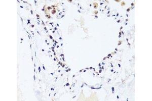 Immunohistochemistry of paraffin-embedded Human lung using BRIX1 Polyclonal Antibody at dilution of 1:100 (40x lens). (BRIX1 Antikörper)