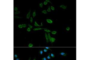 Immunofluorescence analysis of HeLa cells using SIRT7 Polyclonal Antibody (SIRT7 Antikörper)