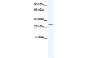 Western Blotting (WB) image for anti-Doublesex and Mab-3 Related Transcription Factor 2 (DMRT2) antibody (ABIN2461540) (DMRT2 Antikörper)