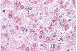 Human Liver (formalin-fixed, paraffin-embedded) stained with CRADD antibody ABIN213922 at 5 ug/ml followed by biotinylated goat anti-rabbit IgG secondary antibody ABIN481713, alkaline phosphatase-streptavidin and chromogen. (CRADD Antikörper  (AA 99-117))