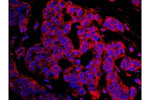 Immunofluorescence (IF) image for anti-Cancer Susceptibility Candidate 3 (CASC3) (AA 653-703) antibody (ABIN7448936) (CASC3 Antikörper  (AA 653-703))