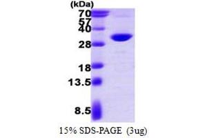 SDS-PAGE (SDS) image for Proteasome (Prosome, Macropain) Activator Subunit 2 (PA28 Beta) (PSME2) (AA 1-239) protein (His tag) (ABIN7529187)