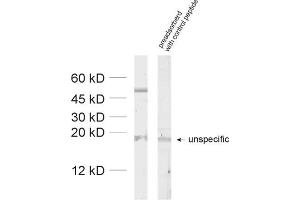 dilution: 1 : 1000, sample: unboiled synaptic membrane fraction of rat brain (LP1) (GABRA2 Antikörper  (AA 29-37))