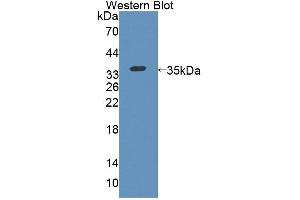 Western blot analysis of the recombinant protein. (KEL Antikörper  (AA 439-713))