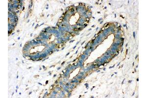 Immunohistochemistry (IHC) image for anti-Transglutaminase 2 (C Polypeptide, Protein-Glutamine-gamma-Glutamyltransferase) (TGM2) (AA 7-34), (N-Term) antibody (ABIN3043946)
