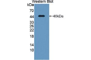 Western blot analysis of the recombinant protein. (POR Antikörper  (AA 210-578))