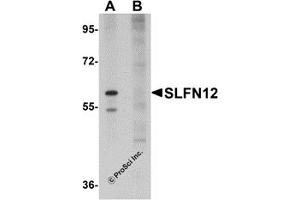 Western Blotting (WB) image for anti-Schlafen Family Member 12 (SLFN12) (C-Term) antibody (ABIN1030678) (SLFN12 Antikörper  (C-Term))