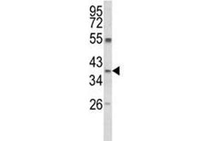 Western Blotting (WB) image for anti-Arginase, Liver (ARG1) (AA 293-322) antibody (ABIN3030017)