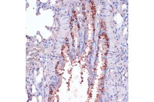 Immunohistochemistry of paraffin-embedded rat lung using RPL22 antibody (ABIN6128682, ABIN6147119, ABIN6147120 and ABIN6224925) at dilution of 1:100 (40x lens). (RPL22 Antikörper  (AA 1-122))