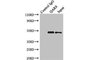 Immunoprecipitating ENTPD5 in Hela whole cell lysate Lane 1: Rabbit control IgG instead of (1 μg) instead of ABIN7151376 in Hela whole cell lysate. (ENTPD5 Antikörper  (AA 149-428))