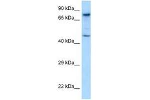 Image no. 1 for anti-SKI-Like Oncogene (SKIL) (AA 542-591) antibody (ABIN6748077) (SKIL Antikörper  (AA 542-591))
