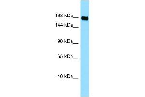 WB Suggested Anti-PLXNB3 Antibody Titration: 1. (Plexin B3 Antikörper  (C-Term))