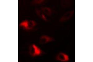 Immunofluorescent analysis of Peroxiredoxin 2 staining in HepG2 cells. (Peroxiredoxin 2 Antikörper)