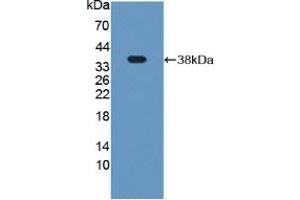 Western blot analysis of recombinant Rat Plg. (PLG Antikörper  (AA 191-433))