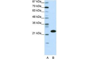 Transfected 293T; WB Suggested Anti-TAF11 Antibody Titration: 0. (TAF11 Antikörper  (N-Term))