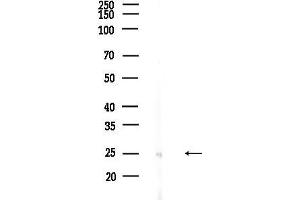 anti-Ribosomal Protein L10 (RPL10) (N-Term) antibody