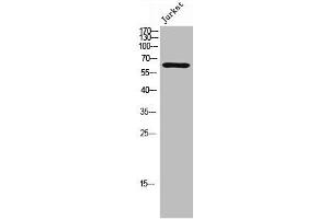 Western Blot analysis of Jurkat cells using Phospho-TIP60 (S86) Polyclonal Antibody (KAT5 Antikörper  (pSer86))