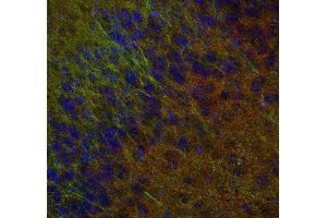 Indirect immunostaining of PFA fixed mouse brain section with anti-synaptogyrin 1 (dilution 1 : 500; red) and mouse anti-MAP 2 (, dilution 1 : 500; green). (Synaptogyrin 1 Antikörper  (AA 220-234))