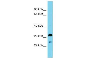 Host: Rabbit Target Name: HSD17B13 Sample Type: Fetal Brain lysates Antibody Dilution: 1. (HSD17B13 Antikörper  (N-Term))