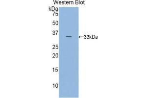 Detection of Recombinant HDC, Rat using Polyclonal Antibody to Histidine Decarboxylase (HDC)