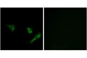 Immunofluorescence analysis of A549 cells, using ATG4A Antibody. (ATG4A Antikörper  (AA 81-130))