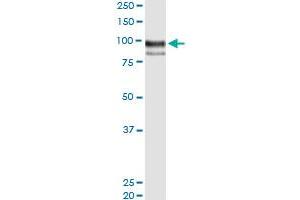 Immunoprecipitation (IP) image for anti-Endoglin (ENG) (AA 1-658) antibody (ABIN515290)