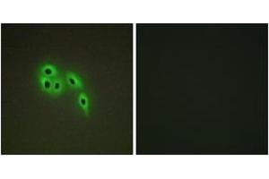 Immunofluorescence analysis of A549 cells, using DOK6 Antibody.