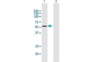 Western Blot analysis of ANXA11 expression in transfected 293T cell line by ANXA11 MaxPab polyclonal antibody. (Annexin A11 Antikörper  (AA 1-505))