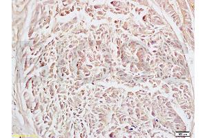 Immunohistochemistry (IHC) image for anti-Adaptor-Related Protein Complex 2, alpha 2 Subunit (AP2A2) (AA 21-150) antibody (ABIN673674)
