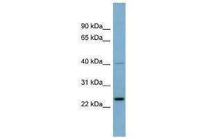 HSPC111 antibody used at 1 ug/ml to detect target protein.