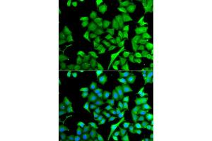 Immunofluorescence analysis of A549 cells using NAA50 antibody (ABIN5975518). (NAA50 Antikörper)