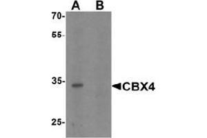Western blot analysis of CBX4 in human brain tissue lysate with CBX4 Antibody  at 1 μg/ml in (A) the absence and (B) the presence of blocking peptide. (CBX4 Antikörper  (N-Term))